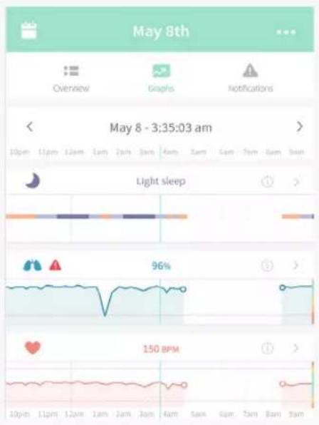 May 8th Overview Graphs Notifications May 8 - 3:35:03 am 10pm 11pm 12pm 1am 2am 3am 4am 5am 6am 7am 8am 9am Light sleep 96% 150 BPM