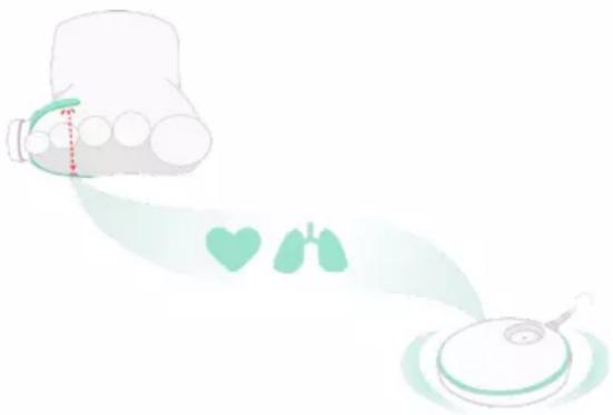 Owlet Smart Sock 3 - Owlet Sock 爱蕾婴儿袜的工作原理 - 1