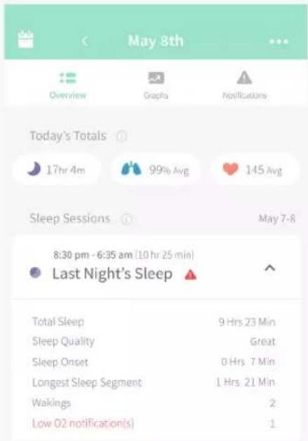 May 8th Overview Graphs Notifications Today's Totals 17hr 4m 99% Avg 145 Avg Sleep Sessions May 7-8 8:30 pm - 6:35 am (10 hr 25 min) Last Night's Sleep Total Sleep 9 Hrs 23 Min Sleep Quality Great Sleep Onset 0 Hrs 7 Min Longest Sleep Segment 1 Hrs 21 Min Wakings 2 Low O2 notification(s) 1