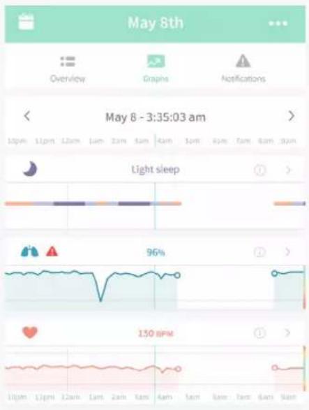 Owlet Smart Sock 3 - Notification de batterie faible de la Sock - 3