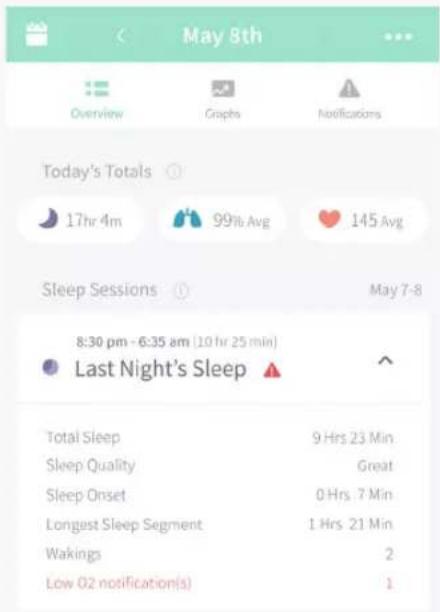 Owlet Smart Sock 3 - Notification de batterie faible de la Sock - 2