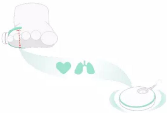 Owlet Smart Sock 3 - Wie funktioniert die Owlet Sock? - 1