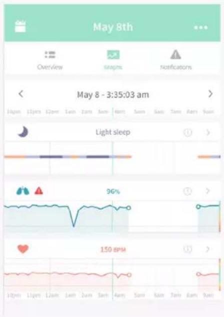 May 8th Overview graphs Notifications < May 8 - 3:35:03 am > 10pm 11pm 12pm 1am 2am 3am 4am Sun Sun Sun Sun Aar Sun Light sleep 96% 150 BPM 10pm 11pm 12am 1am 2am 3am 4am Sun Sun Sun Aar Sun
