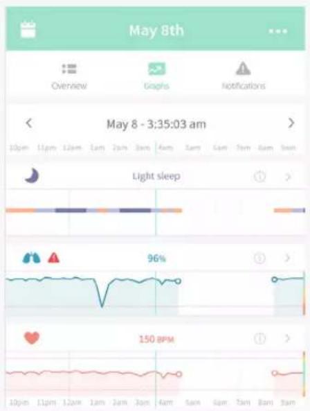 May 8th Overview Graphs Notifications May 8 - 3:35:03 am 10pm 11pm 12pm 1am 2am 3am 4am 5am 6am 7am 8am 9am Light sleep 96% 150 BPM