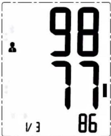 98 77 11 V 3 86