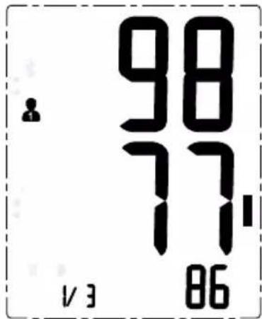 98 77 17 V3 86
