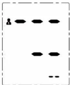 Duronic BPM120 - B: Eliminar todo el historial de registros - 4