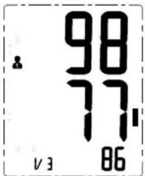 98 77 17 V3 86