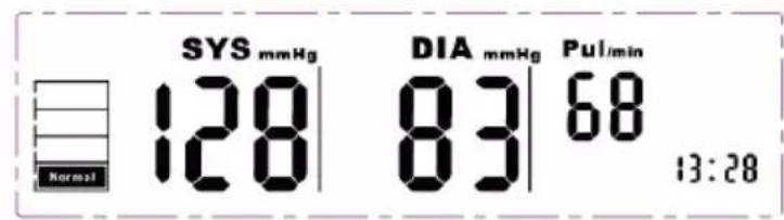 SYS mmHg 128 DIA mmHg 83 Pul/min 68 Normal 13:28
