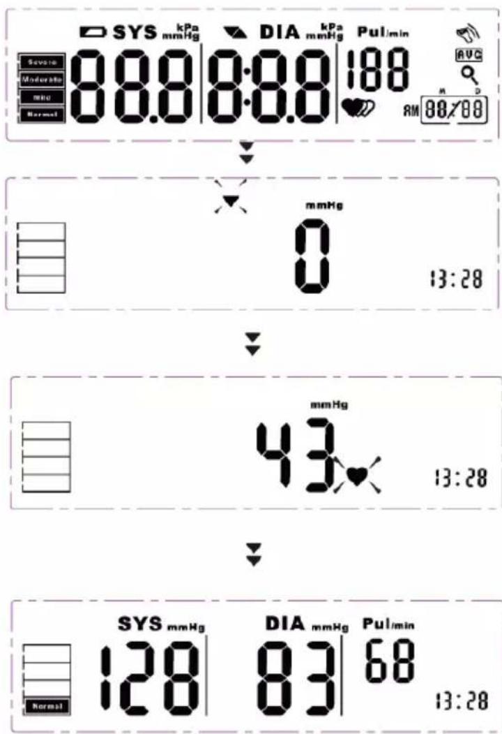 SYS kPa mmHg DIA kPa mmHg Pul/min Severe 88.0 8:0.0 188 Moderate 88/88 Normal AM mmHg 0 13:28 mmHg 43 13:28 SYS mmHg DIA mmHg Pul/min 128 83 68 Normal 13:28