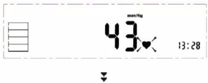 mmHg 43.0 13:28