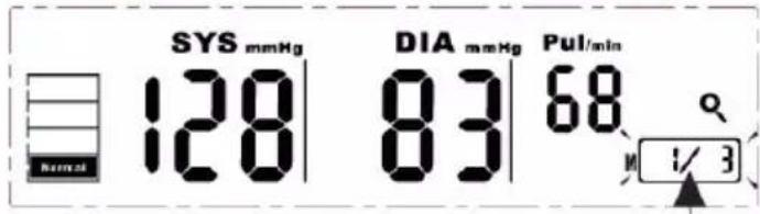 SYS mmHg 128 DIA mmHg 83 68 Pul/min Normal 1/3