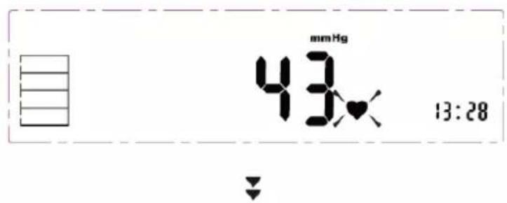 mmHg 43.0 13:28