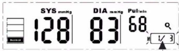 SYS mmHg Normal 128 DIA mmHg 83 Pul/min 68 1/3