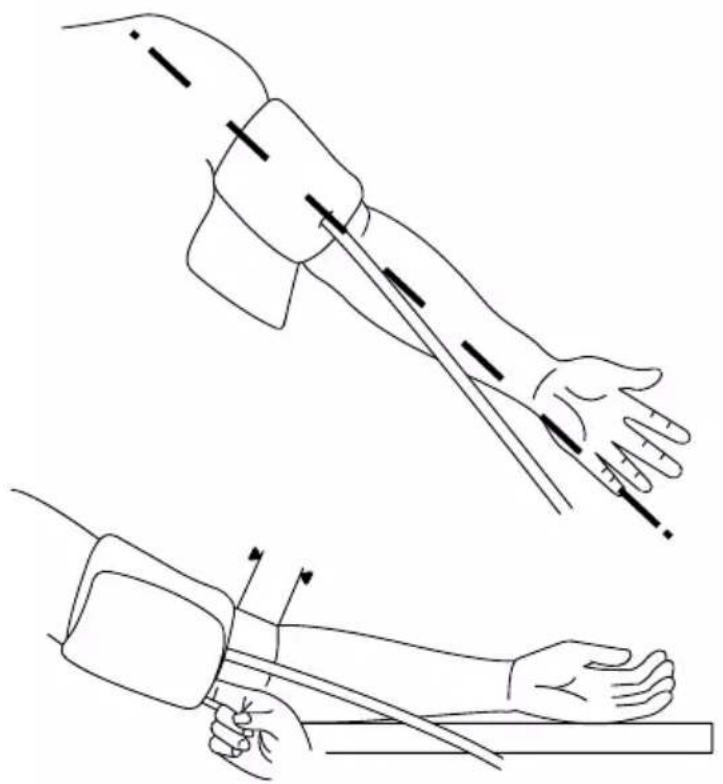 Duronic BPM200 - Applicazione del bracciale - 1