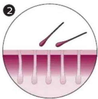 PHILIPS Lumea IPL BRI976 - How IPL works - 2
