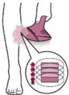 PHILIPS Lumea IPL BRI976 - (BRI955) ملحق الدقة - 19