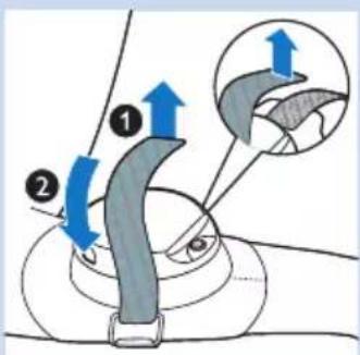 PHILIPS PSK0101 - Nach der Behandlung - 1