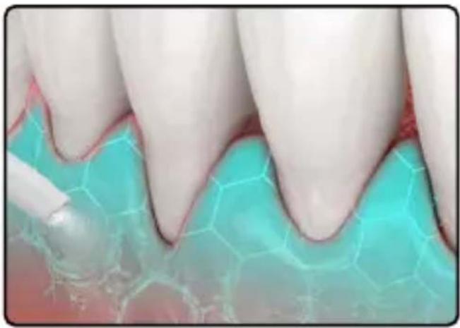 LANAFORM Hydrojet - Mode d'utilisation - 3