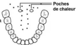 Scala SC 44 - Dans la bouche (orale) - 1