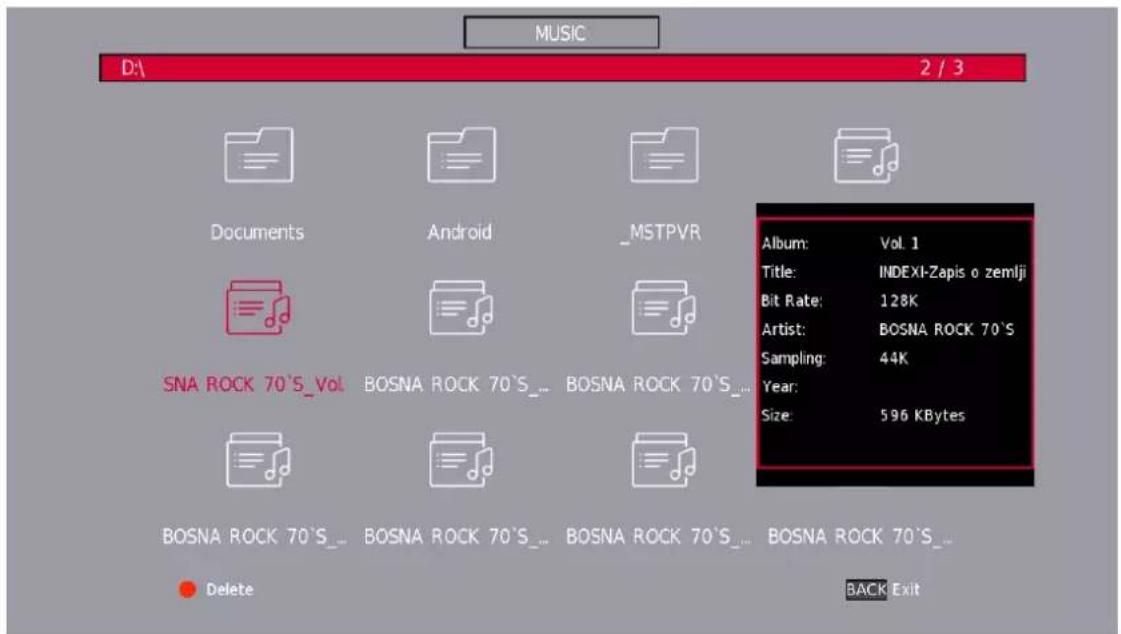 THOMSON Easy TV - Menu Musique - 2