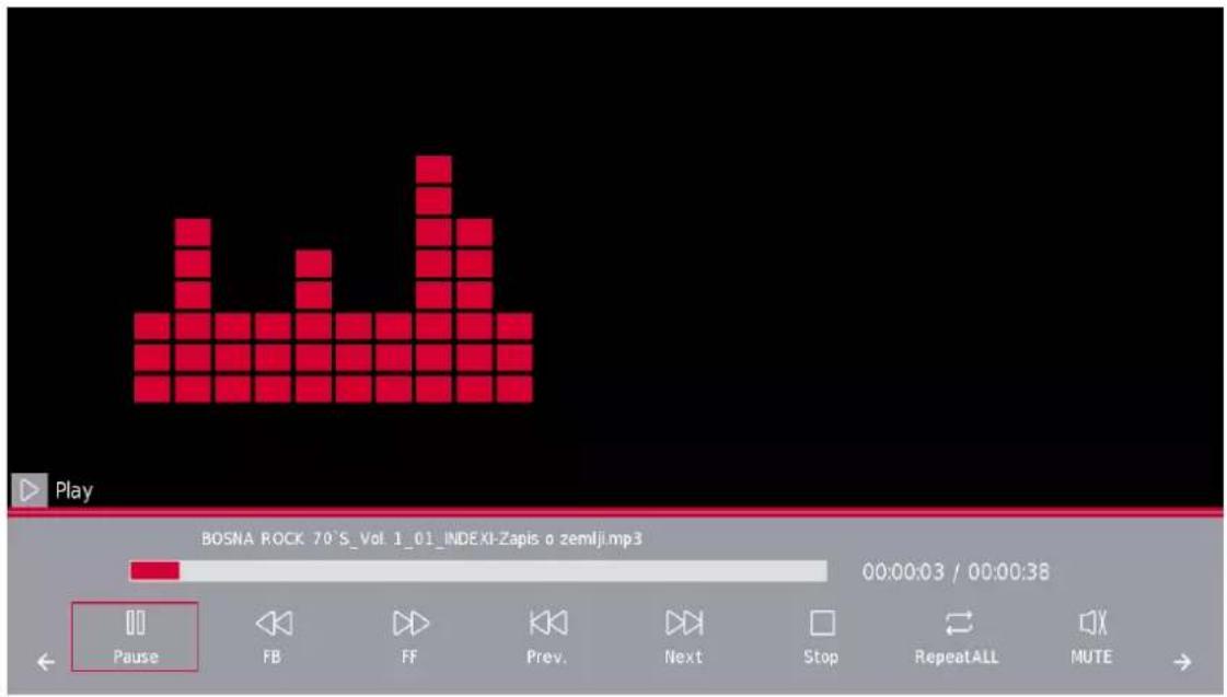 THOMSON Easy TV - Menu Musique - 3
