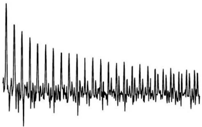 METRIX LX1600 - Instrument « Oscilloscope » (suite) - 3