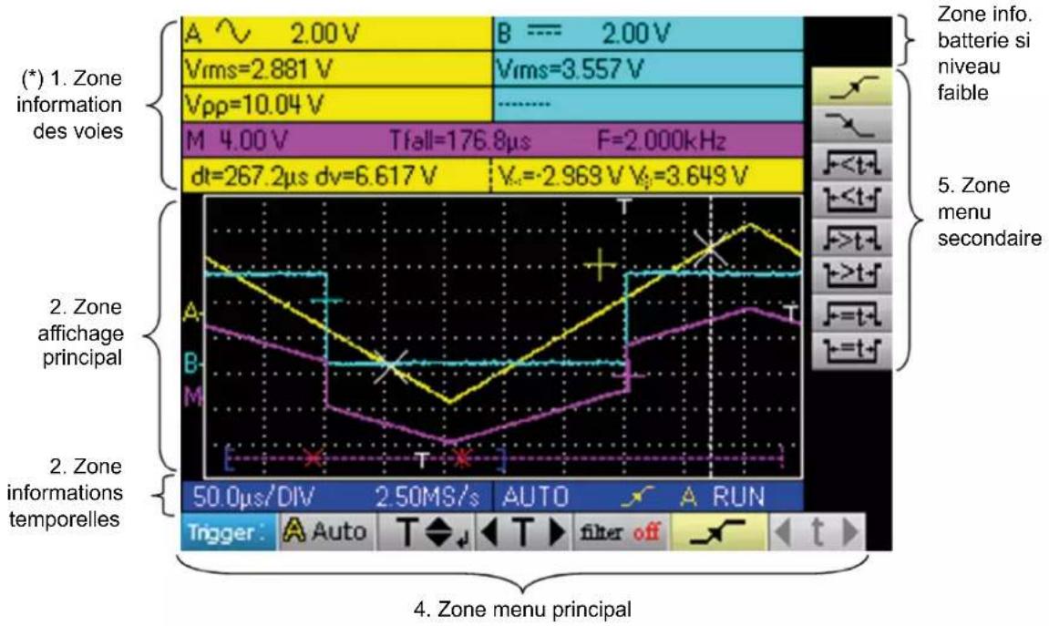 METRIX OX 5042B - VISUALISATION - 1