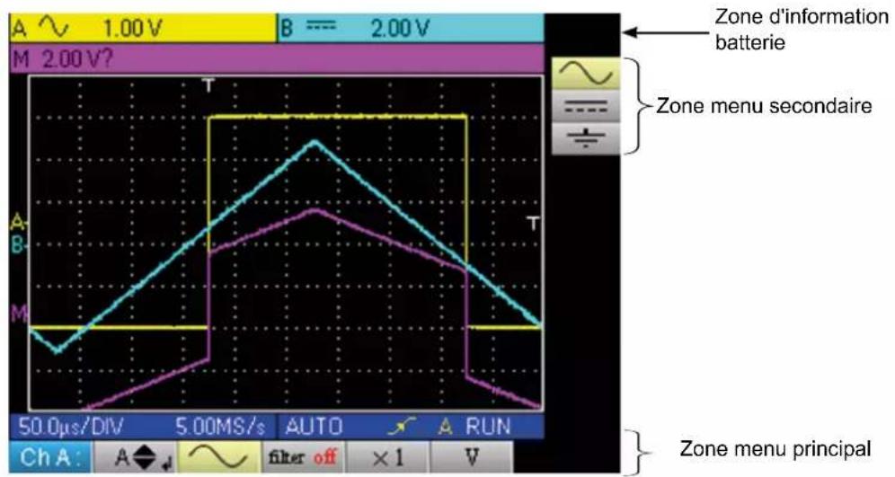 METRIX OX 5042B - VISUALISATION - 1