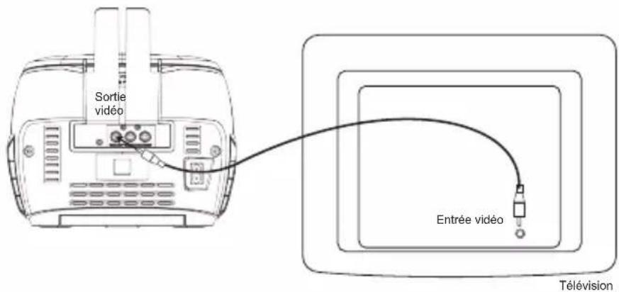 LEXIBOOK K7000 - CONNEXION A UNE TELEVISION ET DES ENCEINTES - 2
