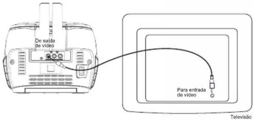 LEXIBOOK K7000 - LIGAR À SUA TELEVISÃO E A OUTROS ALTIFALANTES - 3