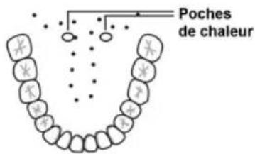 Scala SC 42TM - Dans la bouche (orale) - 1