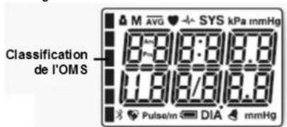 Scala SC 7130 - Qu'est-ce que l'hypotension arterielle? - 3