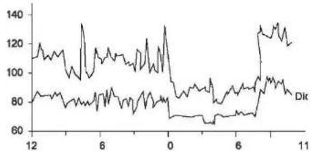 Scala SC 7130 - Qu'est-ce que l'hypotension arterielle? - 1