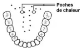 Scala SC 1501 - Dans la bouche (orale) - 1