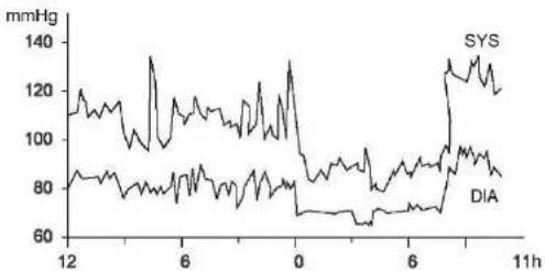 Scala SC 7670 - - Fluctuations de la tension artérielle - 1
