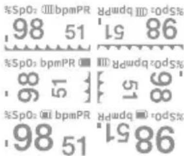 %SpO: III bpmPR 98 51 86 %SpO: III bpmPR 98 51 86 %SpO: bpmPR ■ ■ ■ 51 86 %SpO: bpmPR ■ ■ ■ ■ 51 86 %SpO: bpmPR ■ ■ ■ ■ 51 86 %SpO: bpmPR 98 51 86