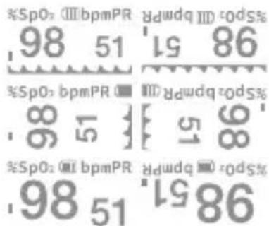 %SpO: Ⅲ bpmPR 86 98 51 98 51 %SpO: Ⅲ bpmPR 86 98 51 %SpO: Ⅲ bpmPR 86 98 51 %SpO: Ⅲ bpmPR 86