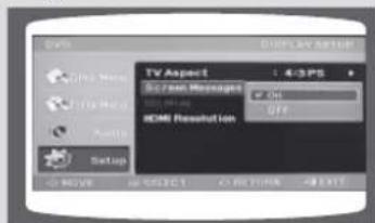 SAMSUNG MAX-DG86 - Configuration du type de l'écran du téléviseur - 4