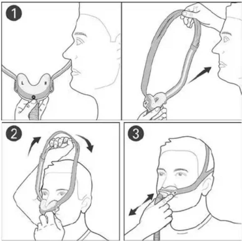 ResMed AirFit N30 - Maske anlegen - 1