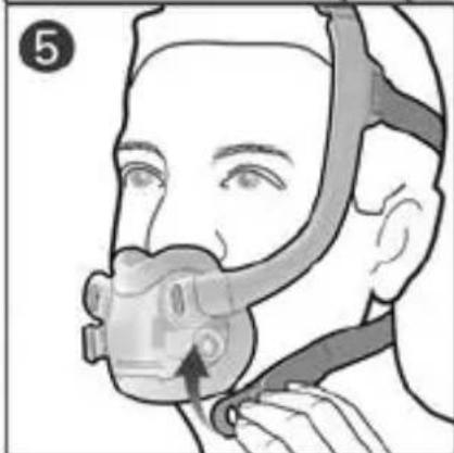 ResMed AirFit F30i - DEUTSCH - 106