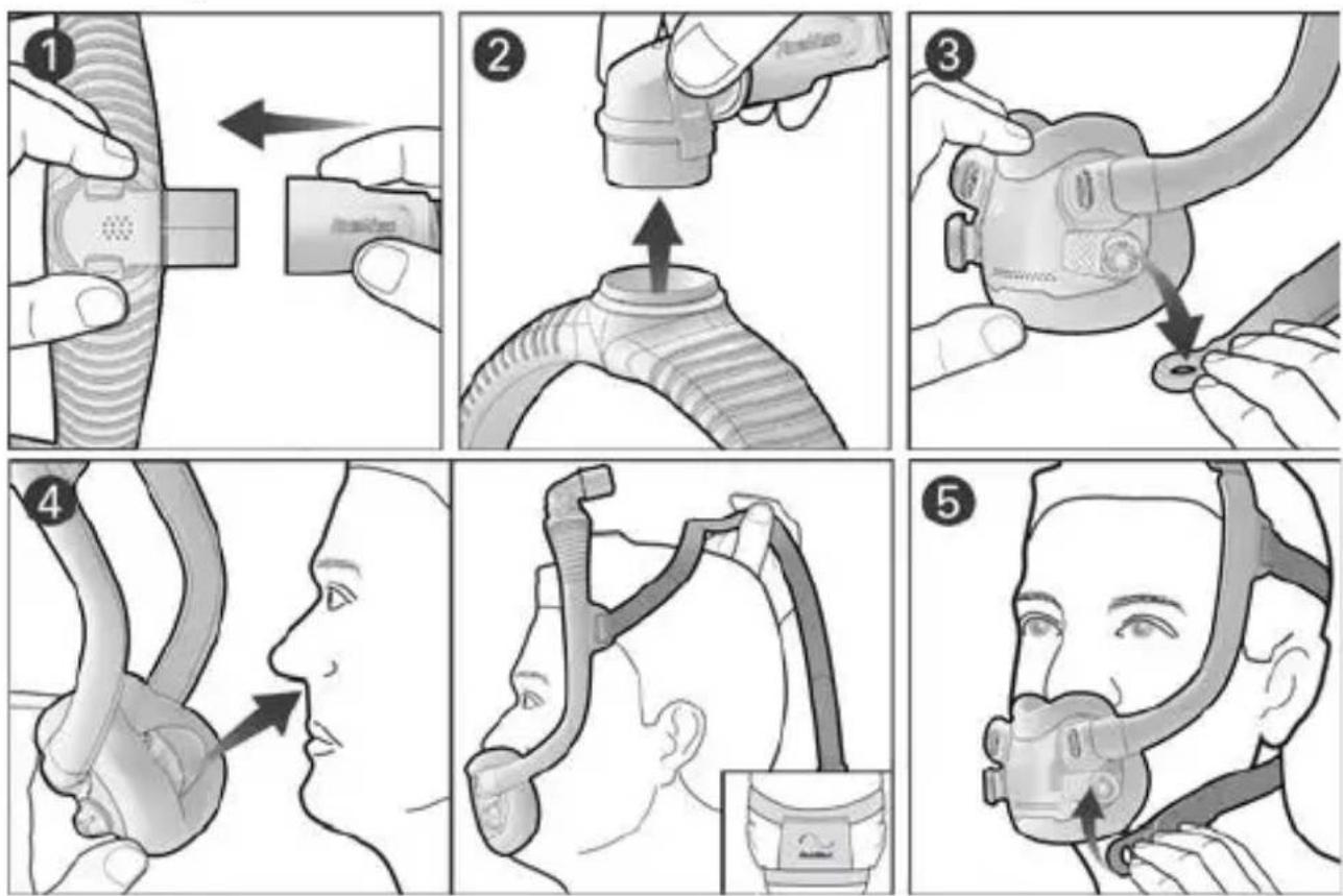 ResMed AirFit F30i - População de pacientes alvo/condições médicas - 1