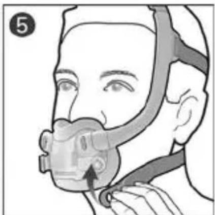 ResMed AirFit F30i - DEUTSCH - 162