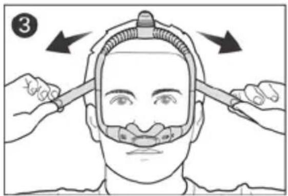 ResMed AirFit P30i - Consumer Warranty - 11