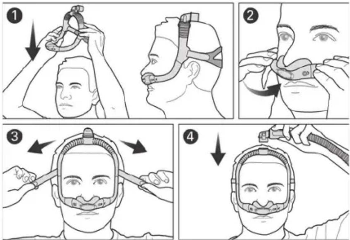 ResMed AirFit P30i - Maske anlegen - 1