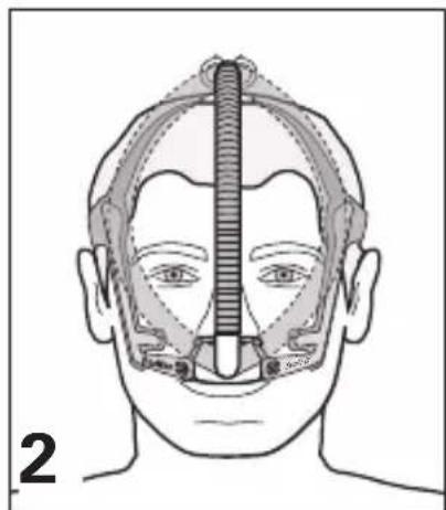 ResMed Swift LT - Using Tube Retainer (Optional) - 2