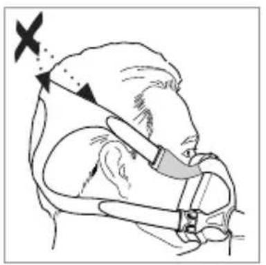 ResMed Quattro FX NV - Headgear position / Kopfbandposition / Position du harnais / Posizione del copricapo - 1