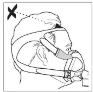 ResMed Quattro FX NV - Headgear position / Kopfbandposition / Position du harnais / Posizione del copricapo - 2