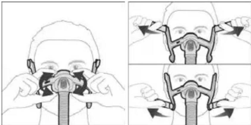 ResMed AirFit N20 - Regolazione della maschera - 1