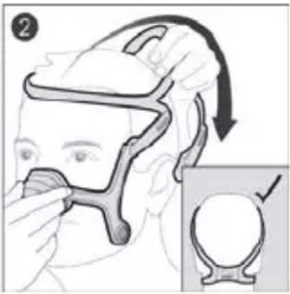 ResMed AirFit N20 - Consumer warranty - 2